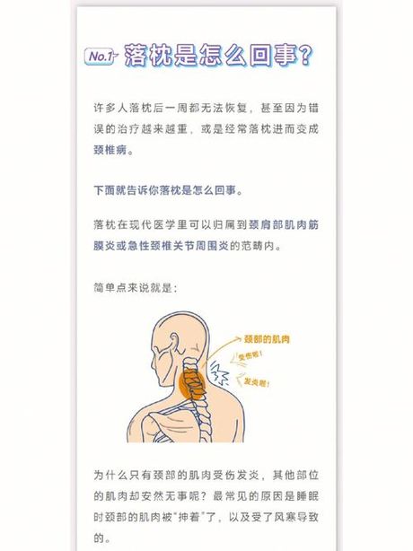 落枕怎么办？