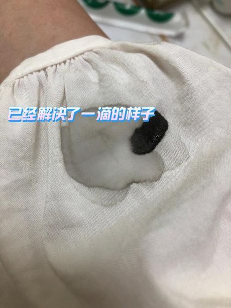 衣服上的胶怎么去除：简单有效的方法