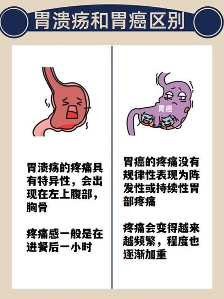 胃癌晚期：生命预期的多方面考量