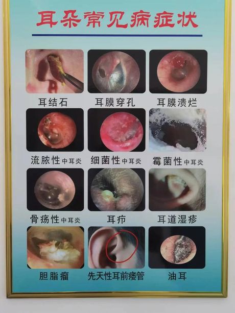 耳朵里面很痒是怎么回事